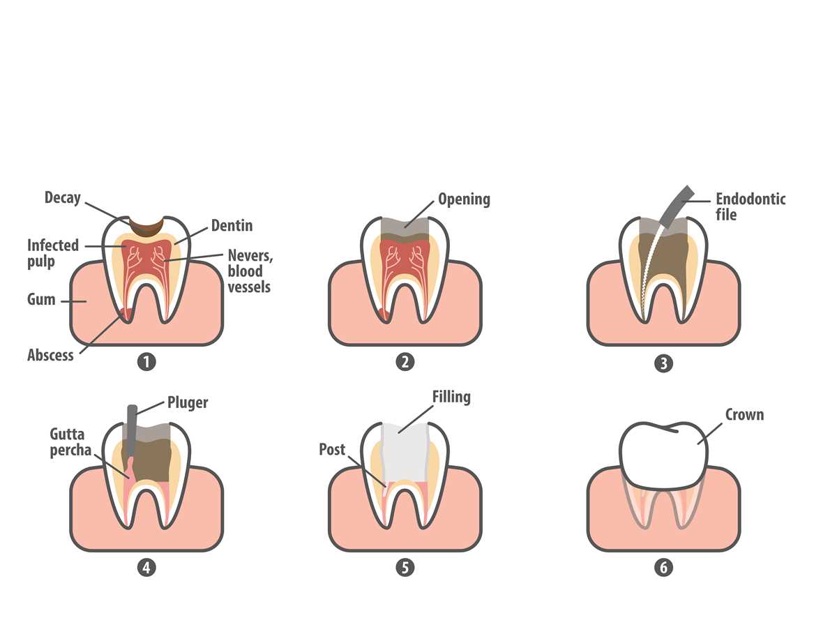 printable dental terminology